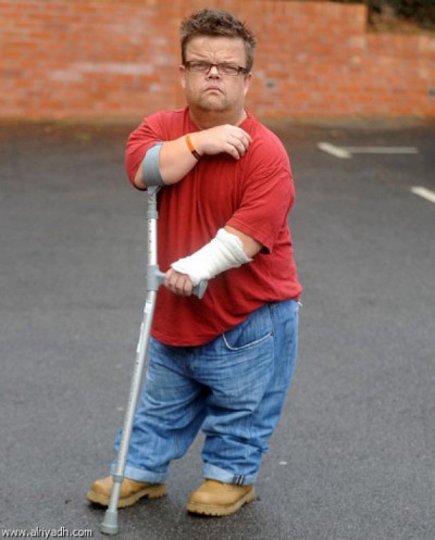 تشريع أردني يعتبر الأقزام معاقين 